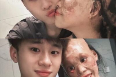 Từ bé tôi đã nổi tiếng xinh nhất vùng, nhưng một s/ự c/ố đã khiến dung nhan của tôi không còn nữa