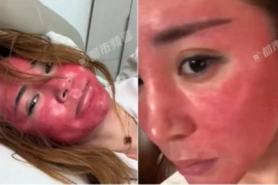 Không tẩy trang suốt 22 năm, làn da cô gái “báo thù” bất ngờ – nhìn “như vảy cá” mà rùng mình