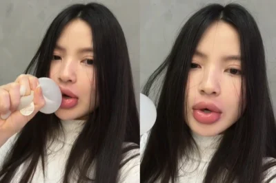 Vợ Quang Hải sang Hàn Quốc x:ử l;;ý filler h-ỏn–g, b-ậ/t kh/ó;c kể lại phút tay chân r;u:n rẩ::y, ti-m đ–ập lạ//c nh//ịp